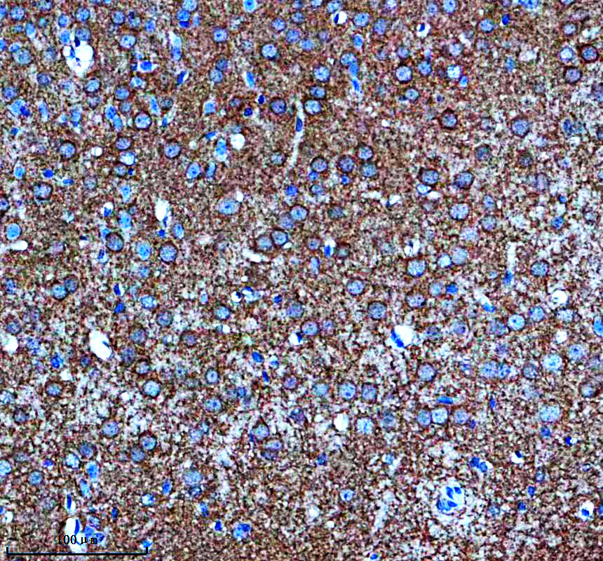 IHC analysis of PLCB4 using anti-PLCB4 antibody (A06404-1)