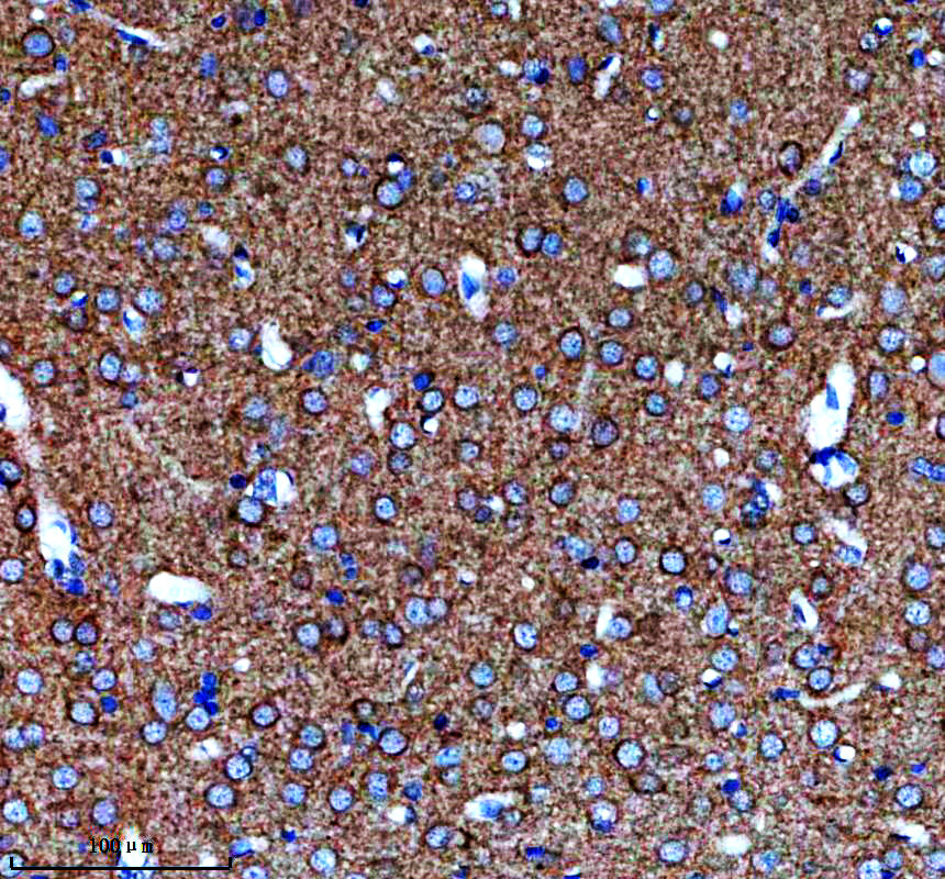 IHC analysis of PLCB4 using anti-PLCB4 antibody (A06404-1)