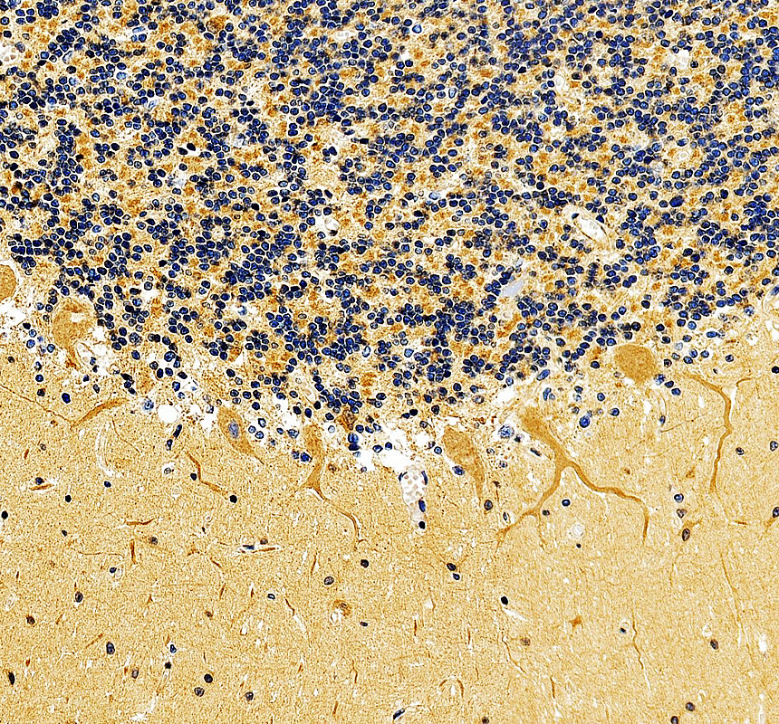 a06404 1 plcb4 primary antibodies ihc testing 3