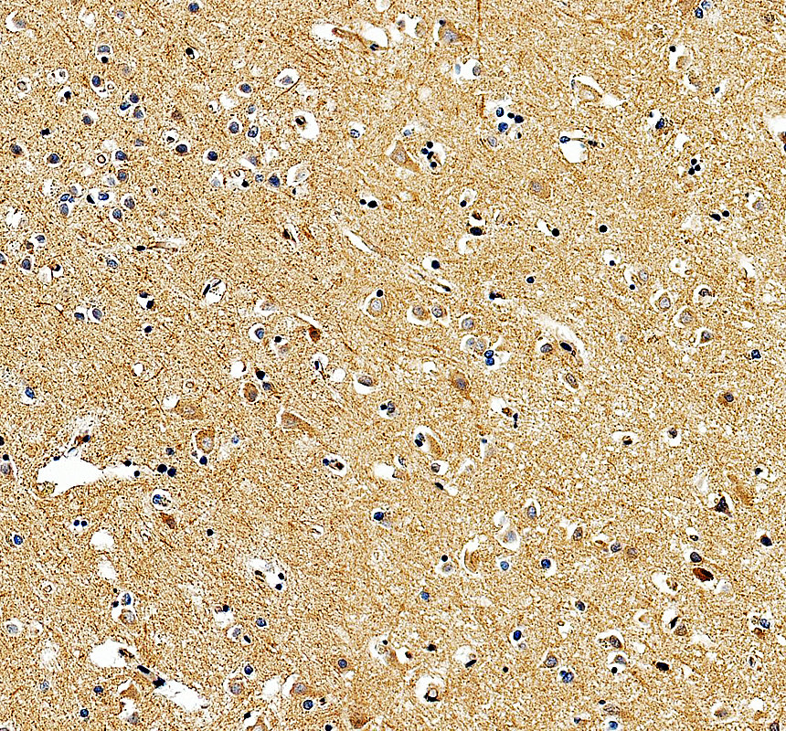 a06404 1 plcb4 primary antibodies ihc testing 4