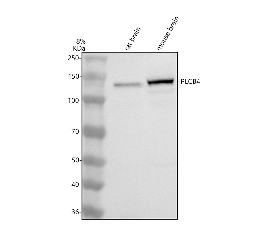 Western blot analysis of PLCB4 using anti-PLCB4 antibody (A06404-1)