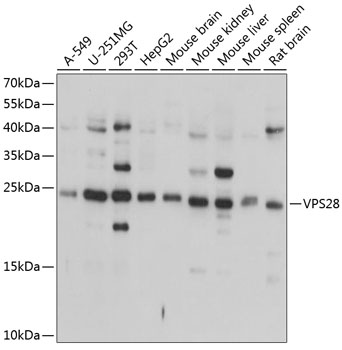 a06407 vps28 primary antiboties wb testing 1