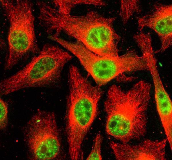 a06415 2 prp4k primary antibodies if testing 1