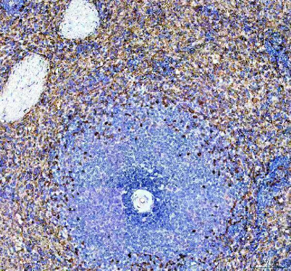 a06420 fcer1g primary antibodies ihc testing 1