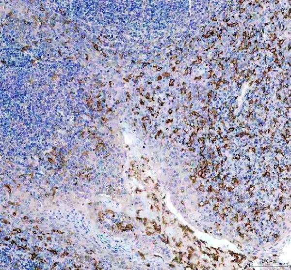 a06420 fcer1g primary antibodies ihc testing 2