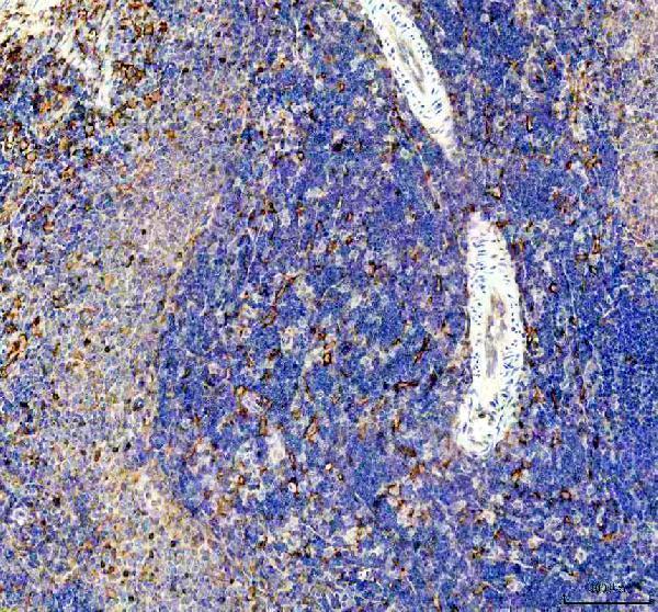 a06420 fcer1g primary antibodies ihc testing 4