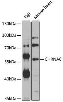 a06421 chrna6 primary antiboties wb testing 1