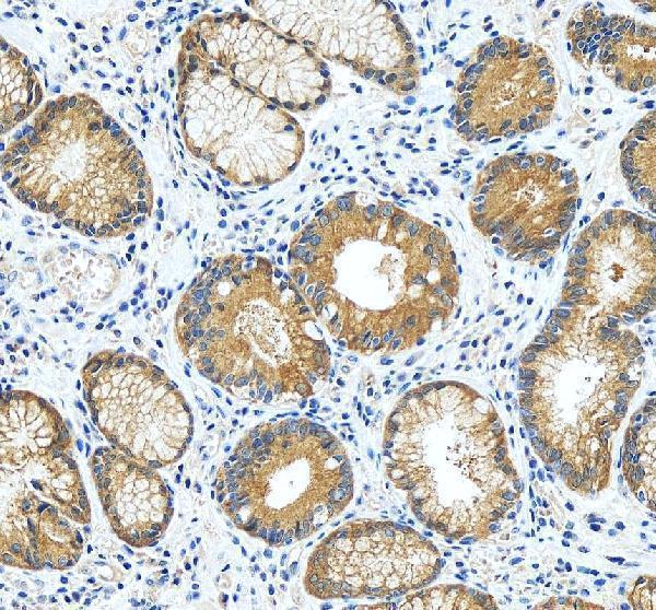 a06423 2 rasal1 primary antibodies ihc testing 7