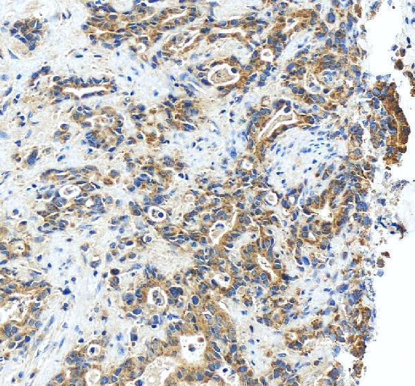 a06423 2 rasal1 primary antibodies ihc testing 8