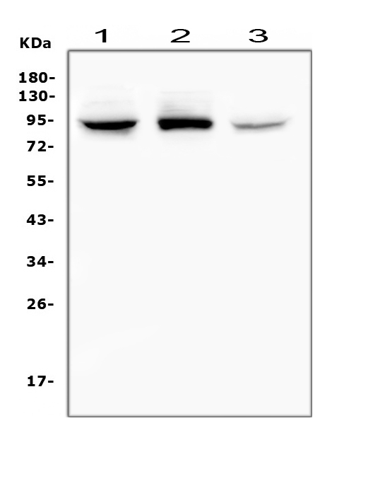 Western blot analysis of RASAL1 using anti-RASAL1 antibody (A06423-2). Electrophoresis was performed on a 5-20% SDS-PAGE gel at 70V (Stacking gel) / 90V (Resolving gel) for 2-3 hours. The sample well of each lane was loaded with 50ug of sample under reducing conditions. Lane 1: rat brain tissue lysates Lane 2: mouse brain tissue lysates Lane 3: human Raji whole cell lysates After Electrophoresis, proteins were transferred to a Nitrocellulose membrane at 150mA for 50-90 minutes. Blocked the membrane with 5% Non-fat Milk/ TBS for 1.5 hour at RT. The membrane was incubated with rabbit anti-RASAL1 antigen affinity purified polyclonal antibody (Catalog # A06423-2) at 0.5 μg/mL overnight at 4°C, then washed with TBS-0.1%Tween 3 times with 5 minutes each and probed with a goat anti-rabbit IgG-HRP secondary antibody at a dilution of 1:10000 for 1.5 hour at RT. The signal is developed using an Enhanced Chemiluminescent detection (ECL) kit (Catalog # EK1002) with Tanon 5200 system. A specific band was detected for RASAL1 at approximately 90KD. The expected band size for RASAL1 is at 90KD.