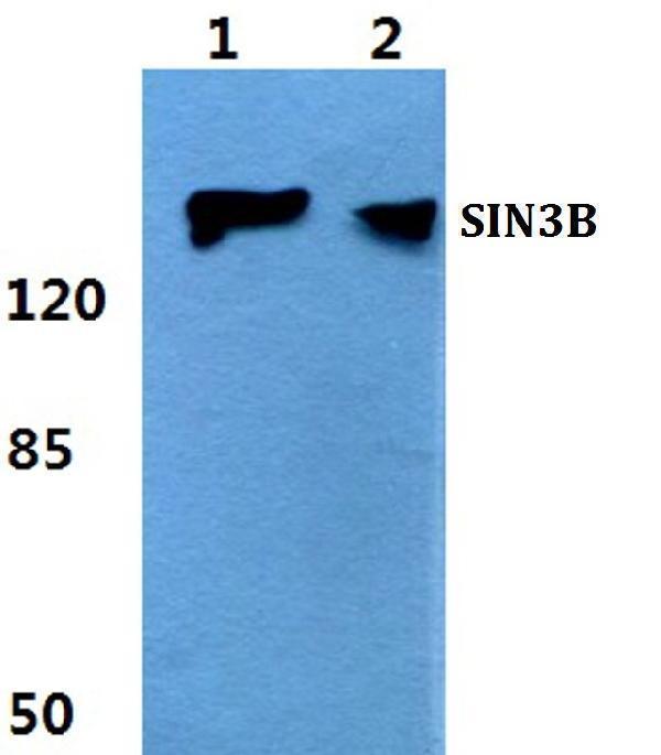 a06424 1 sin3b primary antiboties wb testing 1