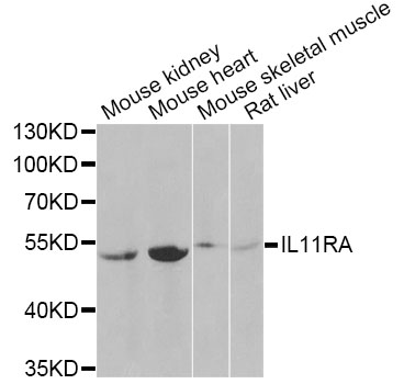 Western blot analysis of extracts of various cell lines, using IL11RA Antibody at 1:1000 dilution
