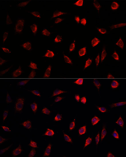 Immunofluorescence analysis of L929 cells using NEDD1 antibody  at dilution of 1:100