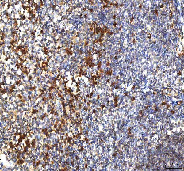  IHC analysis of PCOLCE using anti-PCOLCE antibody (A06428-2)