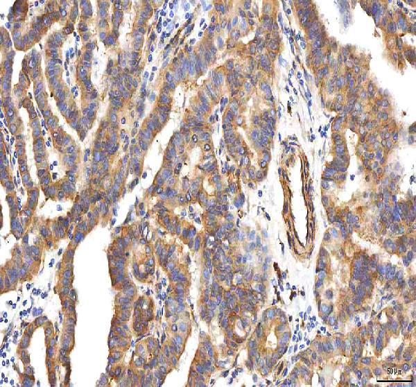  IHC analysis of PCOLCE using anti-PCOLCE antibody (A06428-2)