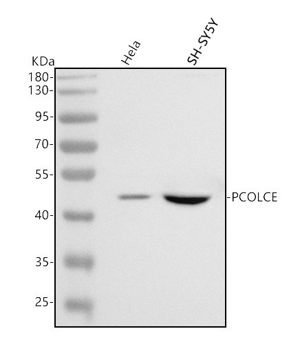  Western blot analysis of PCOLCE using anti-PCOLCE antibody (A06428-2)