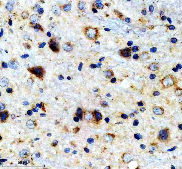 IHC analysis of FBXO31 using anti-FBXO31 antibody (A06429-2)