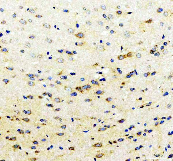 a06429 2 fbxo31 primary antibodies ihc testing 2