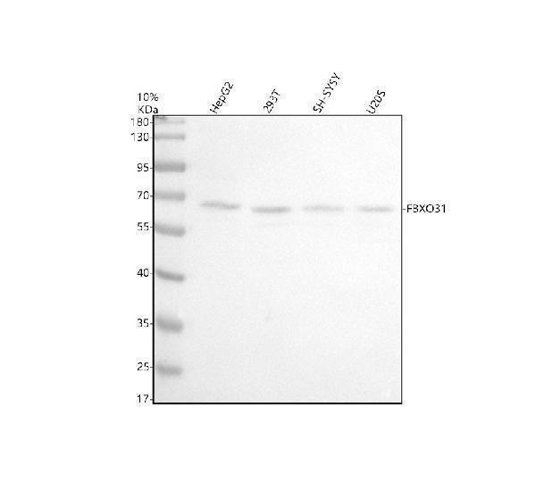 Western blot analysis of FBXO31 using anti-FBXO31 antibody (A06429-2)