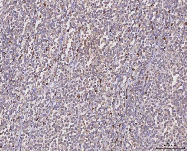  IHC analysis of MGAT2 using anti-MGAT2 antibody (A06432-1)