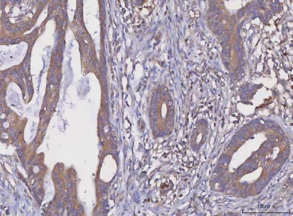  IHC analysis of MGAT2 using anti-MGAT2 antibody (A06432-1)