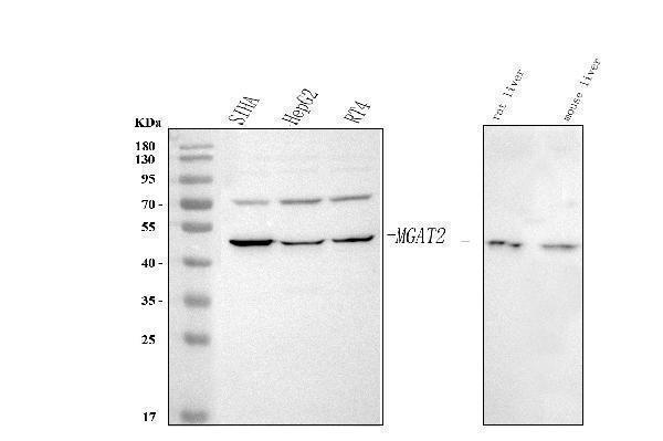  Western blot analysis of MGAT2 using anti-MGAT2 antibody (A06432-1)