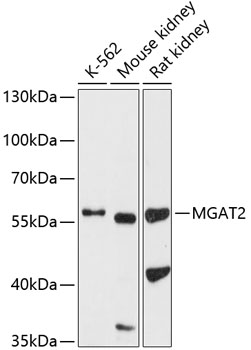 Western blot analysis of extracts of various cell lines, using MGAT2 antibody  at 1:1000 dilution