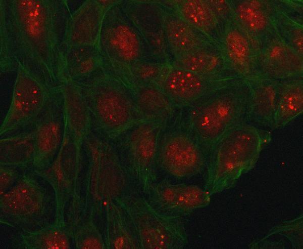  IF analysis of PHC1 using anti-PHC1 antibody (A06437-3)