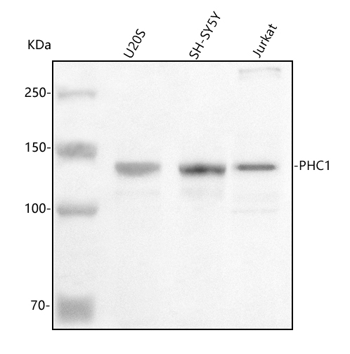  Western blot analysis of PHC1 using anti-PHC1 antibody (A06437-3)