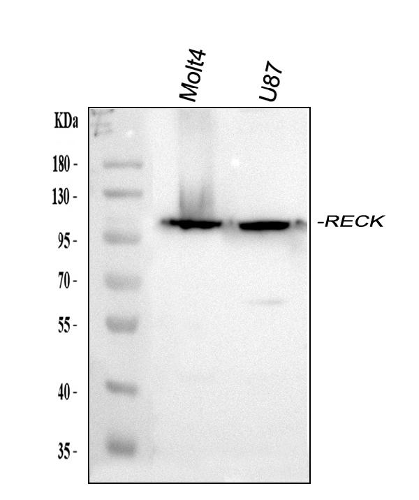 Western blot analysis of RECK using anti-RECK antibody (A06439-1).