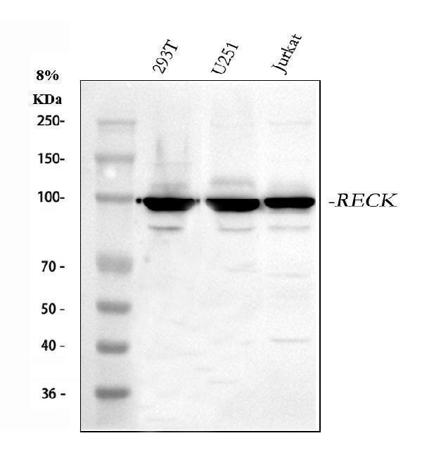  Western blot analysis of RECK using anti-RECK antibody (A06439-3)