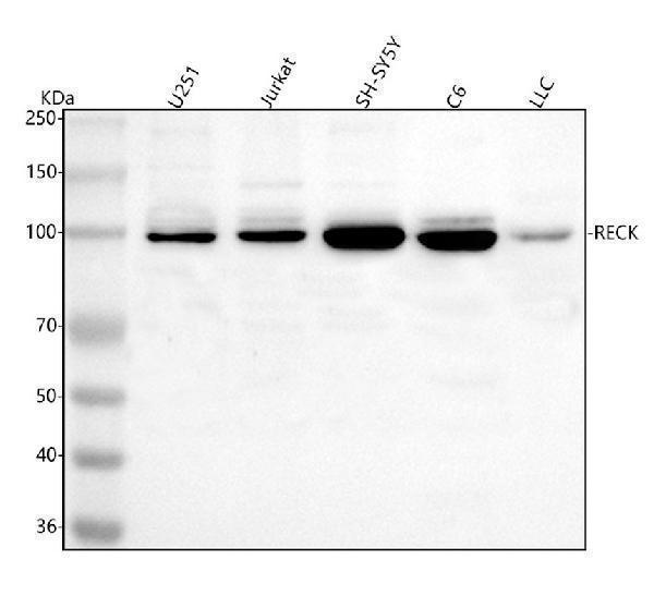  Western blot analysis of RECK using anti-RECK antibody (A06439-4)