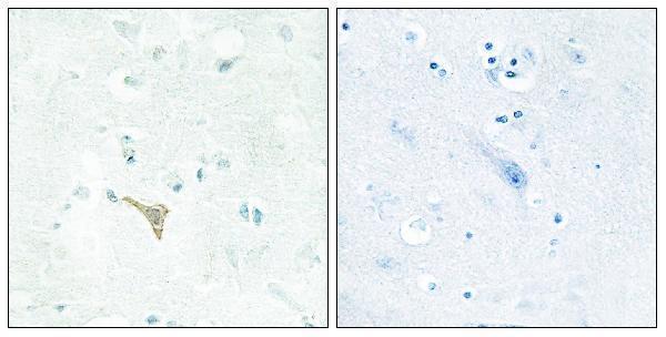 a06439 reck primary antibodies ihc testing 2
