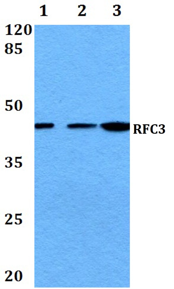 Western blot (WB) analysis of RFC3 (L227) polyclonal antibody at 1:500 dilution
Lane1:HepG2 whole cell lysate
Lane2:Raw264
