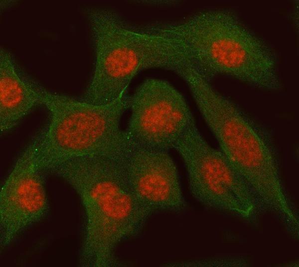  IF analysis of RFC3 using anti-RFC3 antibody (A06442-2) and anti-Tubulin Alpha antibody (M03989-3)