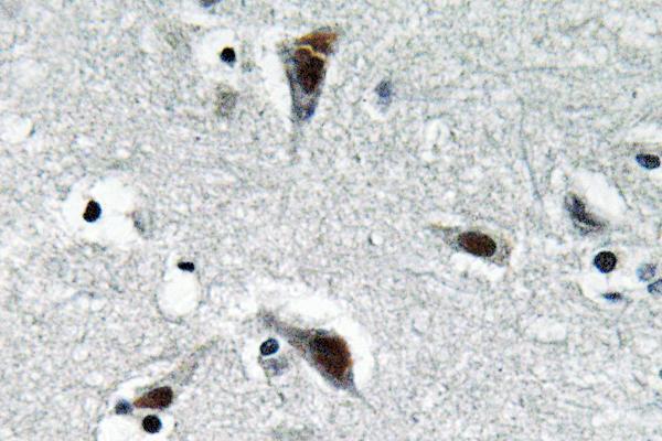 a06442 rfc3 primary antibodies ihc testing 1