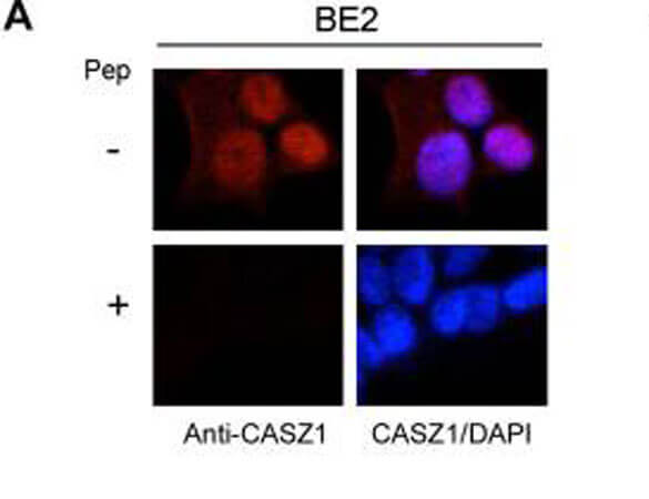 Immunofluorescence results of Endogenous CASZ1
