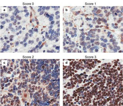 Immunohistochemistry results of Rabbit Anti-hCASZ1 Antibody