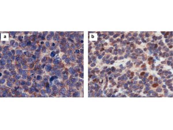 Immunohistochemistry results of Rabbit Anti-hCasz1 Antibody