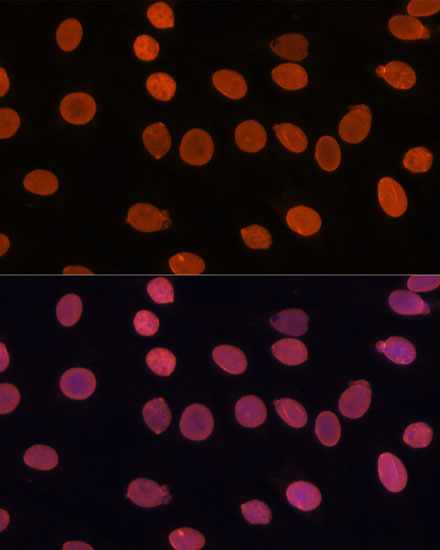 Immunofluorescence analysis of C6 cells using TADA3 antibody  at dilution of 1:100