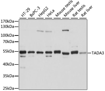 Western blot analysis of extracts of various cell lines, using TADA3 antibody  at 1:1000 dilution