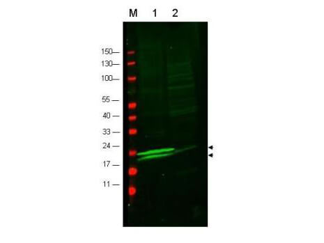 Western blot using Boster's anti-RLC of Smooth and Non-muscle Myosin antibody to detect vascular myosin (rat aorta, lane 1) but not cardiac myosin (mouse heart, lane2)