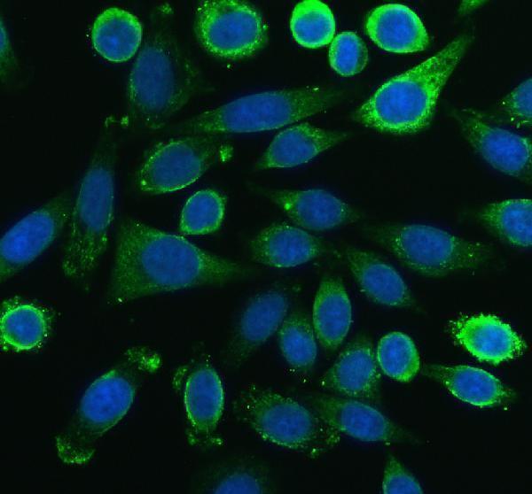 IF analysis of PFKL using anti-PFKL antibody (A06447-2)