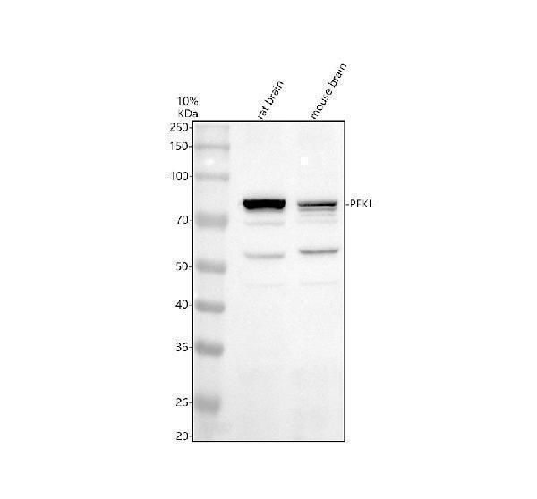 Western blot analysis of PFKL using anti-PFKL antibody (A06447-2)