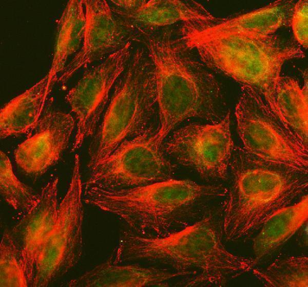  IF analysis of PPP2R5D using anti-PPP2R5D antibody (A06450-1) and anti-Tubulin Alpha antibody (M03989-3)