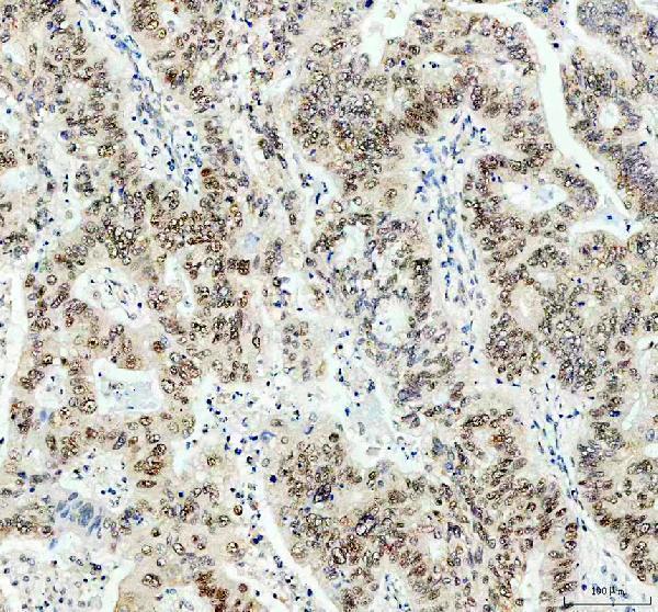  IHC analysis of PPP2R5D using anti-PPP2R5D antibody (A06450-1)