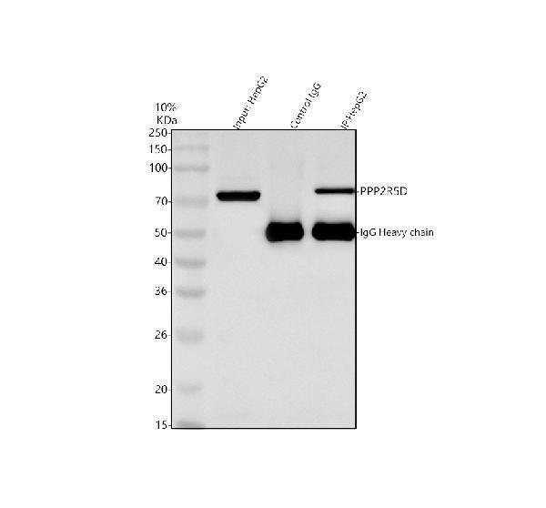 a06450 1 ppp2r5d primary antibodies ip testing 4