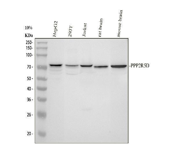  Western blot analysis of PPP2R5D using anti-PPP2R5D antibody (A06450-1)