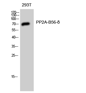 Western blotting validation for Anti-PP2A-B56-delta PPP2R5D Antibody A06450
Western Blot (WB) analysis of 293T cells using PP2A-B56-delta polyclonal antibody