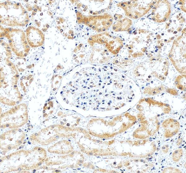 a06454 rps26 primary antibodies ihc testing 1